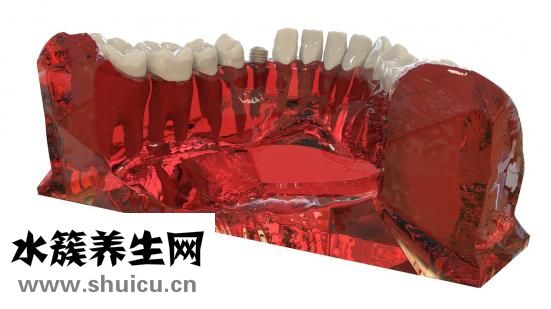 松動牙齒加固辦法