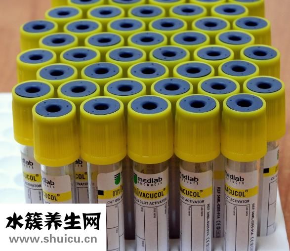什么是血漿