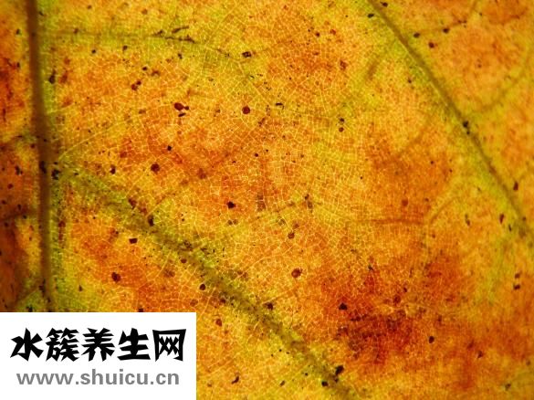 擴張性心肌病