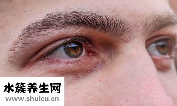 出絕眼怎么辦