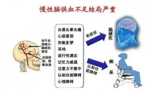 腦供血不足有三大癥狀，腦供血不足有三大癥狀吃什么藥