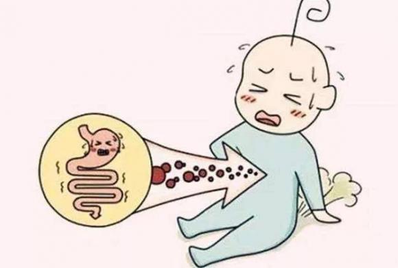結腸炎的10個征兆，結腸炎患者癥狀表現
