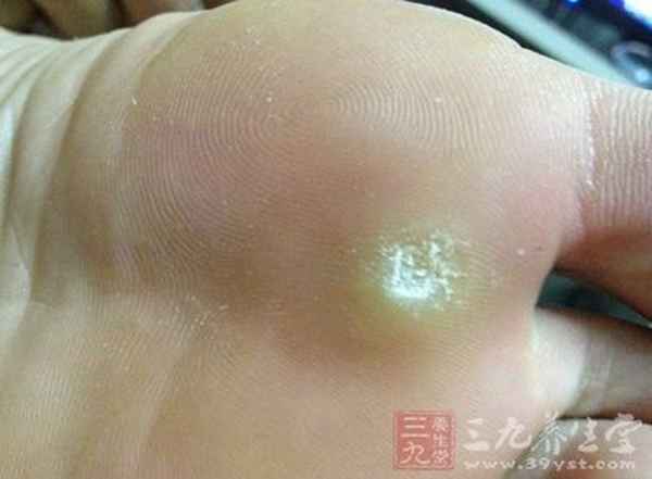 一吃就硬的25種偏方，夫妻之間多久同房一次才算正常