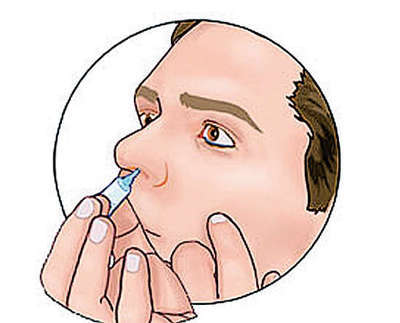 鼻咽癌前期的18種預兆有哪些（鼻咽癌前期的18種預兆）