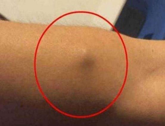 身體里長個小疙瘩摸著硬硬的（摸著硬硬的）