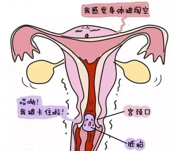 女人打胎一次身體變化為什么現在醫院都不給藥流（女人打胎一次身體變化）