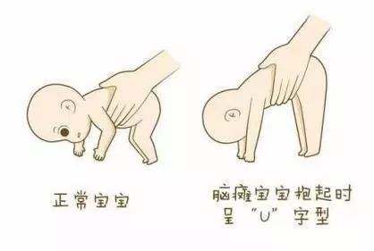 八個動作看寶寶腦癱圖六個多月的體重正常是多少（八個動作看寶寶腦癱圖）