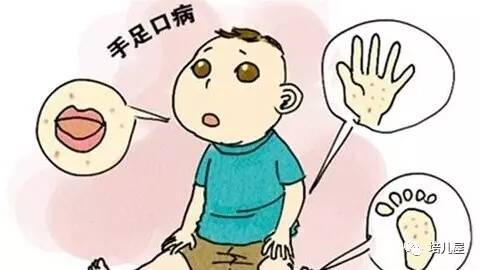 新生兒腦膜炎的早期癥狀（腦膜炎的早期癥狀）