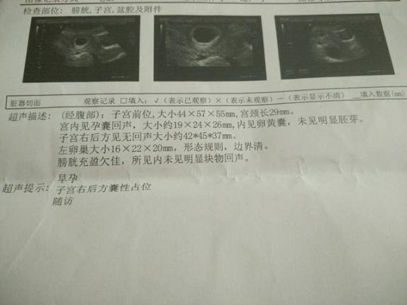 貓咪怎么看懷孕沒有（怎么看懷孕沒有）
