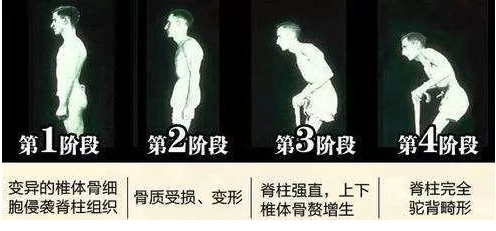 男性性疾病初期癥狀腿部（男性性疾病初期癥狀）