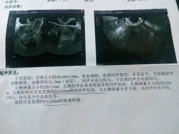 怎么看出來有沒有懷孕（怎么確定有沒有懷孕呢）