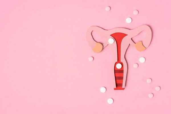 女性盆腔炎能自愈嗎（盆腔炎一般三處疼痛）