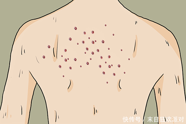 紅斑狼瘡比癌癥可怕嗎（紅斑狼瘡和癌癥哪個可怕）