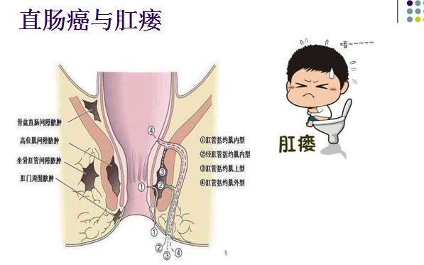 初期肛瘺外口圖片（肛瘺外口照片）