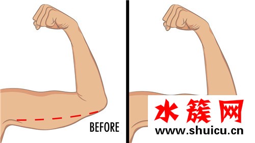 蝴蝶臂是什么樣的