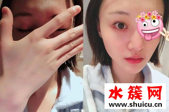 鄭爽現在屬于什么臉型